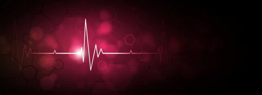 electrocardiogram