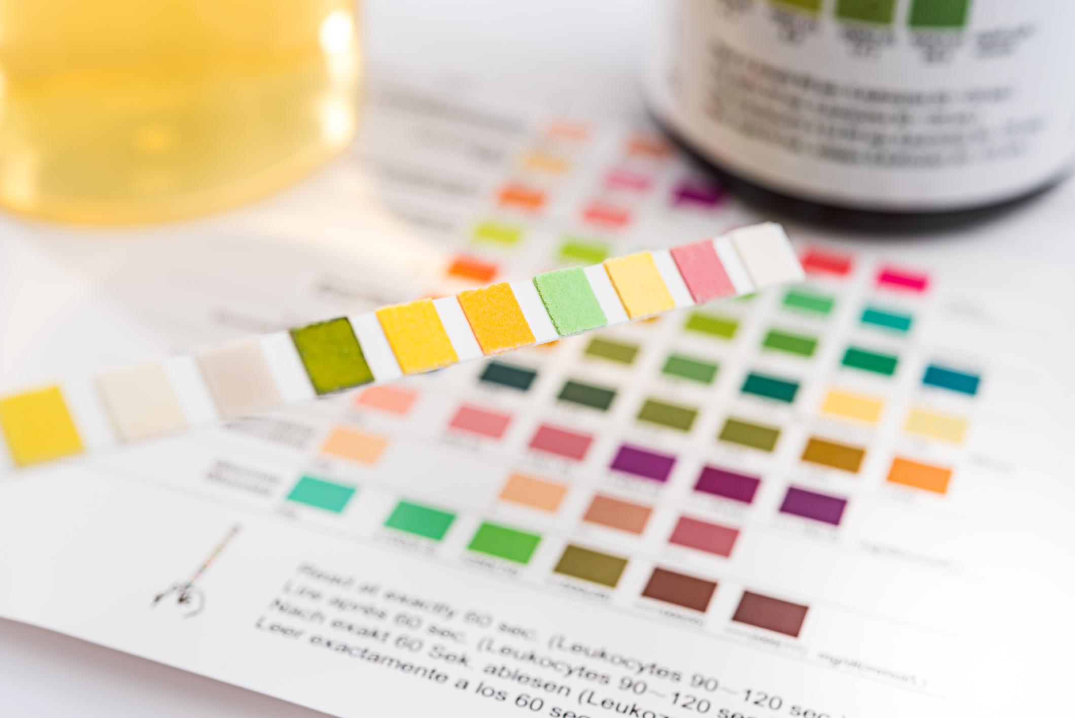 A close-up of a urinalysis test strip with multiple colored pads held above a comparison chart showing various color indicators.